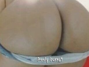 Assly_burn69